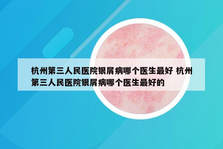 杭州第三人民医院银屑病哪个医生最好 杭州第三人民医院银屑病哪个医生最好的