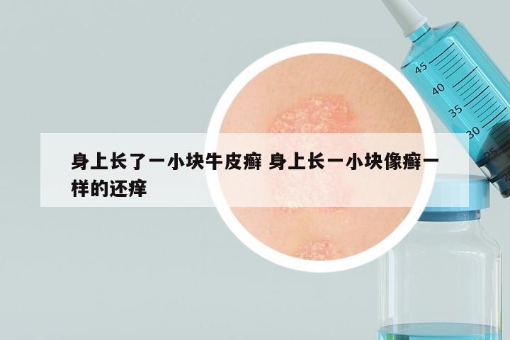 身上长了一小块牛皮癣 身上长一小块像癣一样的还痒