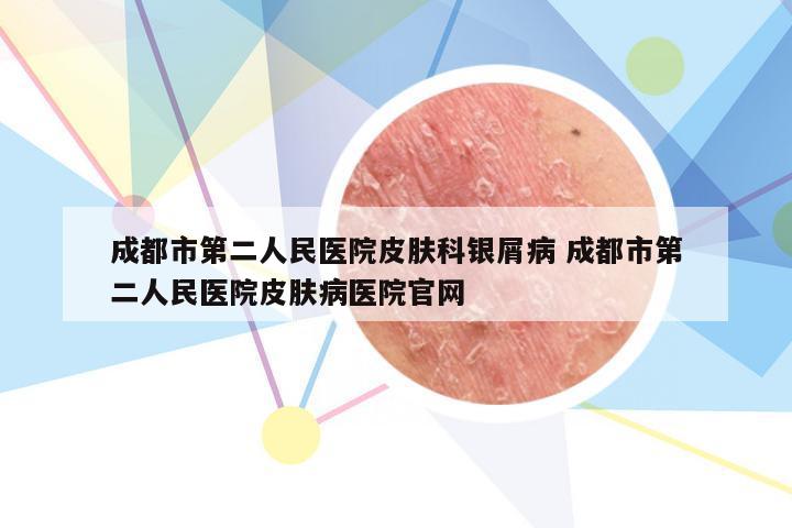 成都市第二人民医院皮肤科银屑病 成都市第二人民医院皮肤病医院官网