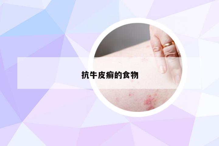 抗牛皮癣的食物