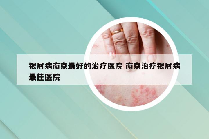 银屑病南京最好的治疗医院 南京治疗银屑病最佳医院