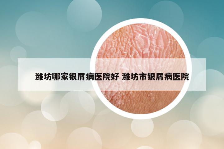潍坊哪家银屑病医院好 潍坊市银屑病医院