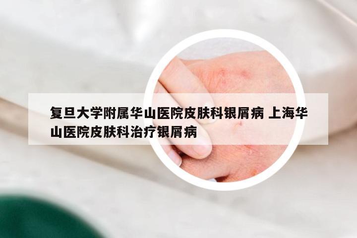 复旦大学附属华山医院皮肤科银屑病 上海华山医院皮肤科治疗银屑病