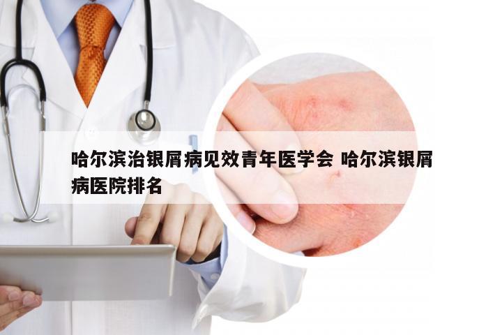 哈尔滨治银屑病见效青年医学会 哈尔滨银屑病医院排名