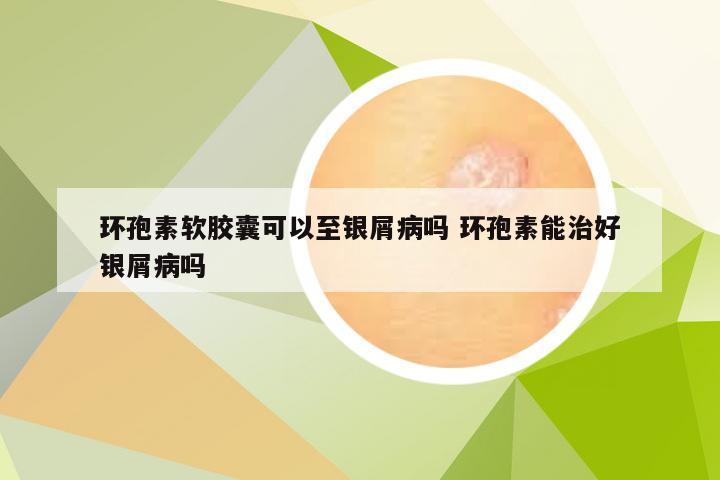 环孢素软胶囊可以至银屑病吗 环孢素能治好银屑病吗
