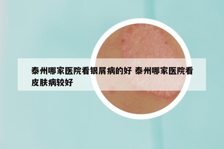 泰州哪家医院看银屑病的好 泰州哪家医院看皮肤病较好