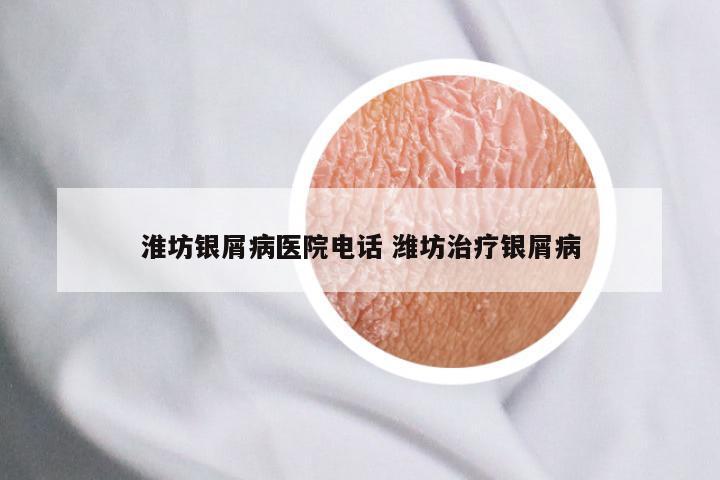 淮坊银屑病医院电话 潍坊治疗银屑病