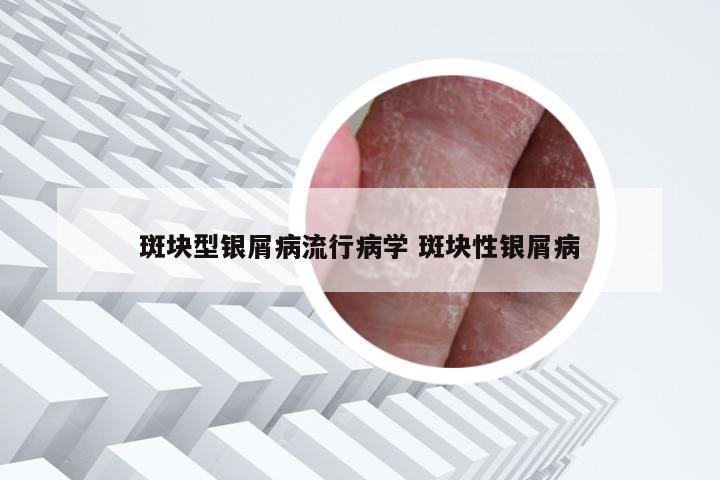 斑块型银屑病流行病学 斑块性银屑病