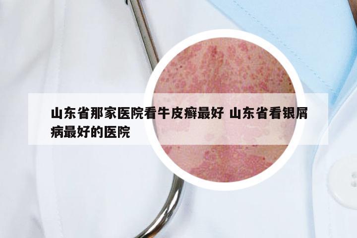 山东省那家医院看牛皮癣最好 山东省看银屑病最好的医院