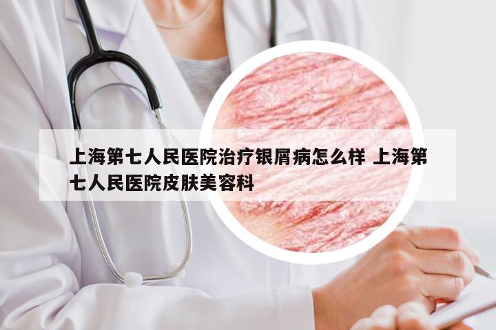 上海第七人民医院治疗银屑病怎么样 上海第七人民医院皮肤美容科