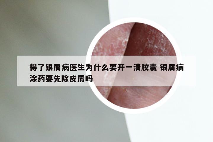 得了银屑病医生为什么要开一清胶囊 银屑病涂药要先除皮屑吗