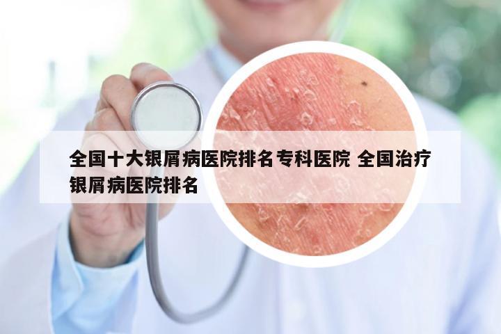 全国十大银屑病医院排名专科医院 全国治疗银屑病医院排名