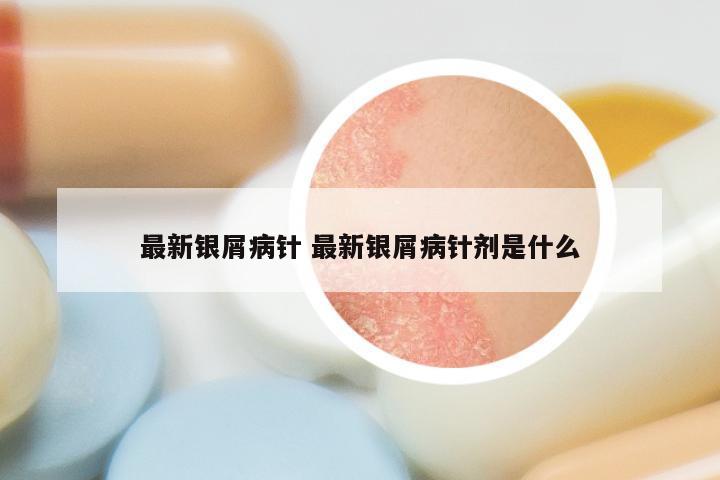 最新银屑病针 最新银屑病针剂是什么