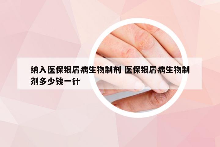 纳入医保银屑病生物制剂 医保银屑病生物制剂多少钱一针