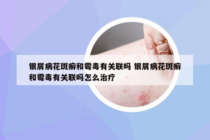 银屑病花斑癣和霉毒有关联吗 银屑病花斑癣和霉毒有关联吗怎么治疗