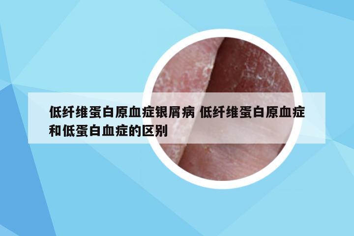 低纤维蛋白原血症银屑病 低纤维蛋白原血症和低蛋白血症的区别