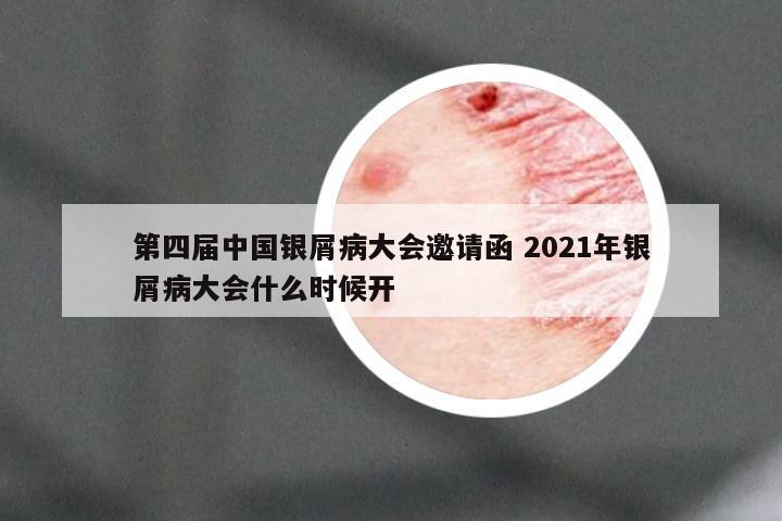 第四届中国银屑病大会邀请函 2021年银屑病大会什么时候开