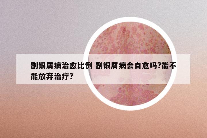 副银屑病治愈比例 副银屑病会自愈吗?能不能放弃治疗?