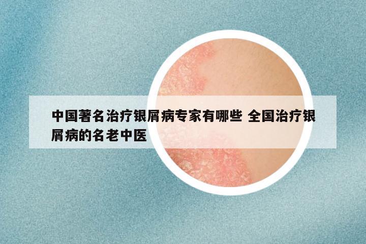 中国著名治疗银屑病专家有哪些 全国治疗银屑病的名老中医