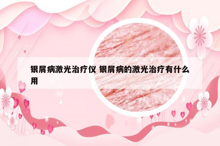 银屑病激光治疗仪 银屑病的激光治疗有什么用
