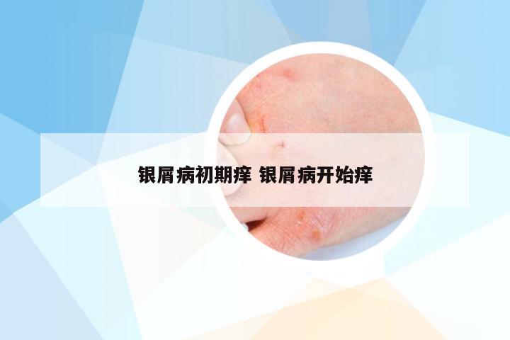 银屑病初期痒 银屑病开始痒