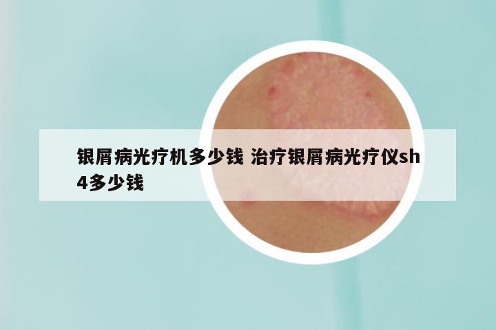 银屑病光疗机多少钱 治疗银屑病光疗仪sh4多少钱