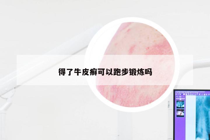 得了牛皮癣可以跑步锻炼吗