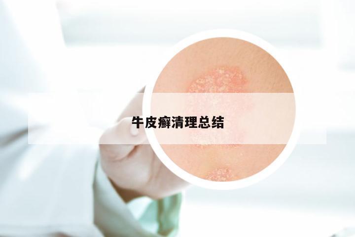牛皮癣清理总结