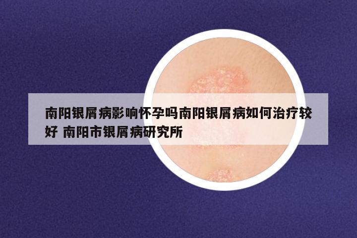 南阳银屑病影响怀孕吗南阳银屑病如何治疗较好 南阳市银屑病研究所