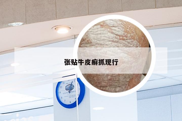 张贴牛皮癣抓现行