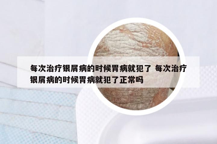 每次治疗银屑病的时候胃病就犯了 每次治疗银屑病的时候胃病就犯了正常吗