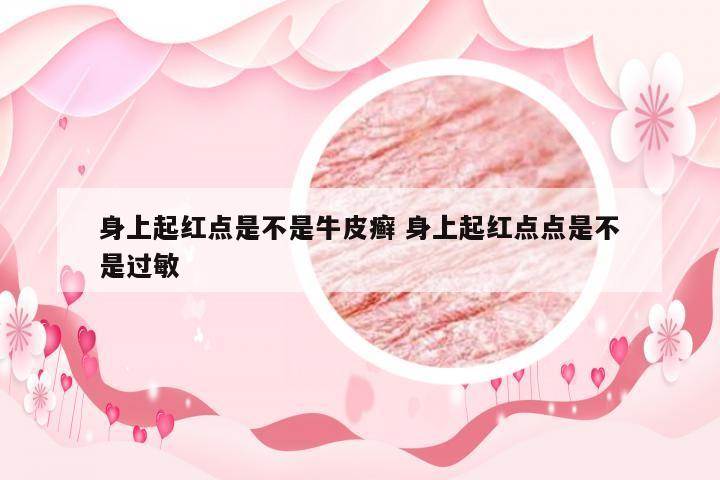 身上起红点是不是牛皮癣 身上起红点点是不是过敏
