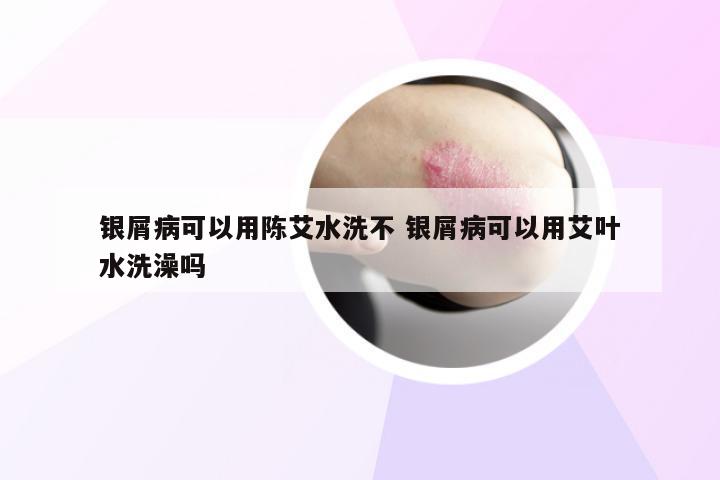银屑病可以用陈艾水洗不 银屑病可以用艾叶水洗澡吗