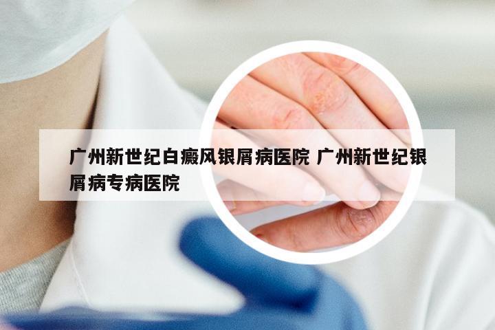 广州新世纪白癜风银屑病医院 广州新世纪银屑病专病医院