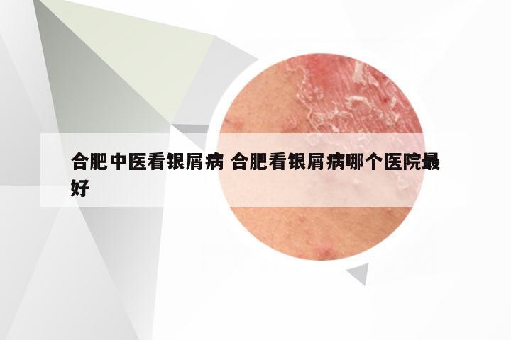 合肥中医看银屑病 合肥看银屑病哪个医院最好