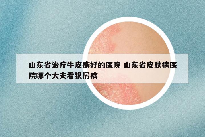 山东省治疗牛皮癣好的医院 山东省皮肤病医院哪个大夫看银屑病