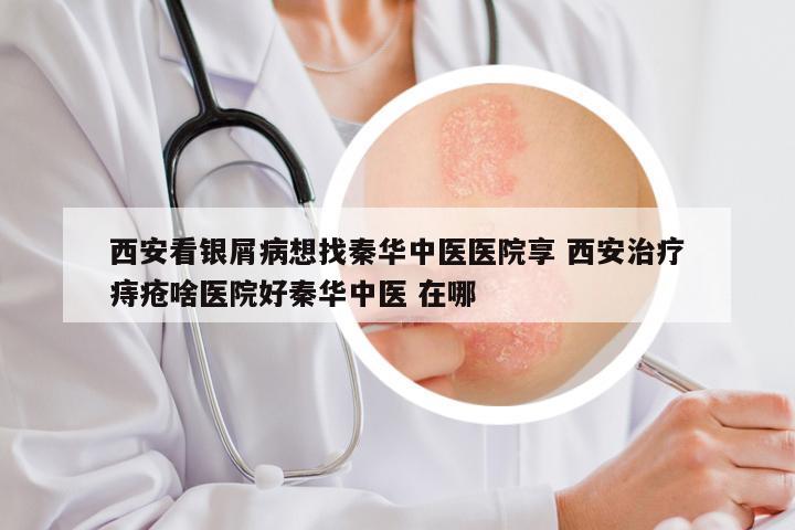 西安看银屑病想找秦华中医医院享 西安治疗痔疮啥医院好秦华中医 在哪