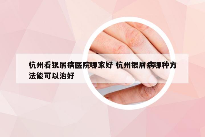 杭州看银屑病医院哪家好 杭州银屑病哪种方法能可以治好