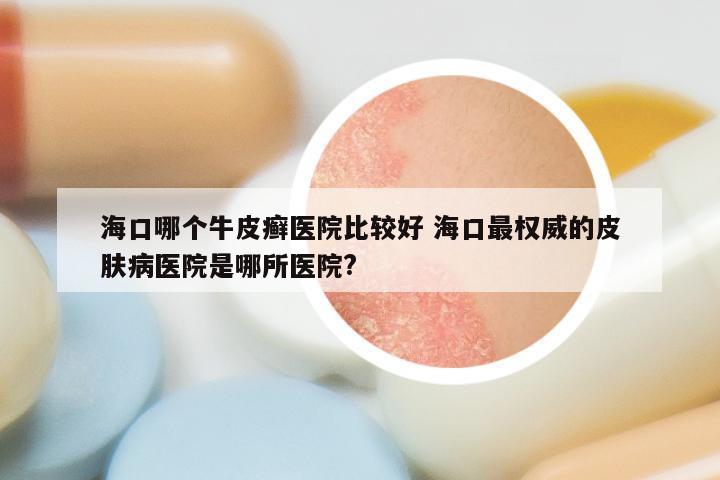 海口哪个牛皮癣医院比较好 海口最权威的皮肤病医院是哪所医院?