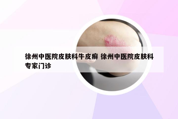 徐州中医院皮肤科牛皮癣 徐州中医院皮肤科专家门诊