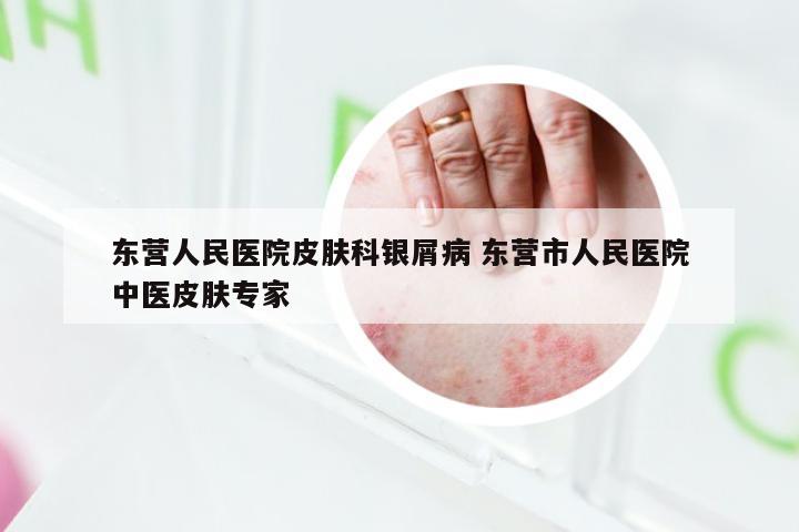 东营人民医院皮肤科银屑病 东营市人民医院中医皮肤专家