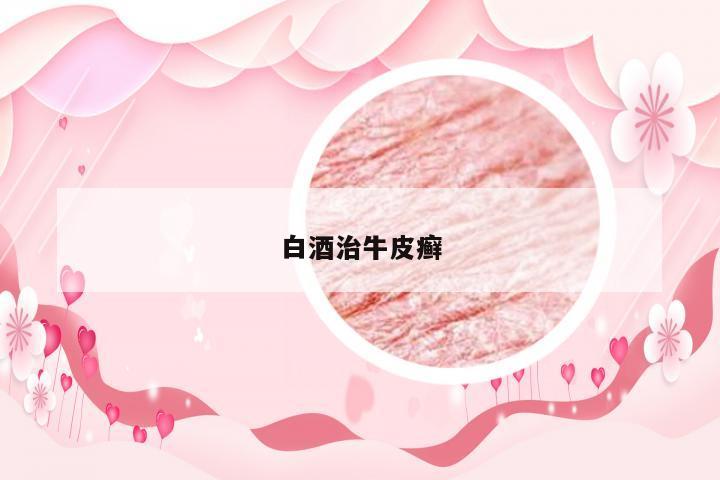 白酒治牛皮癣