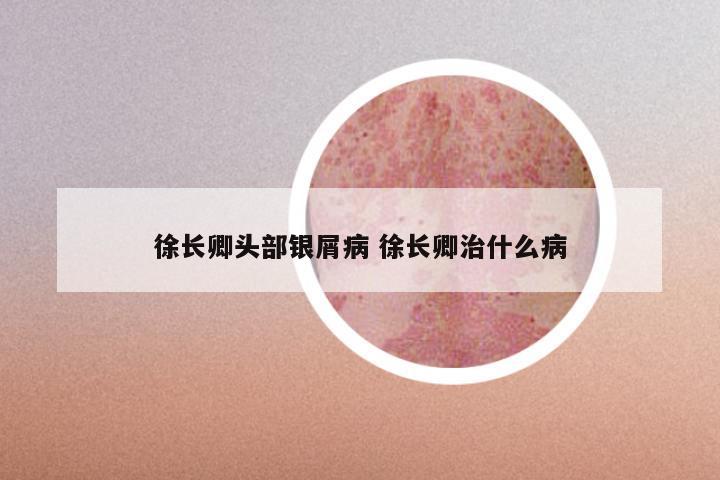 徐长卿头部银屑病 徐长卿治什么病