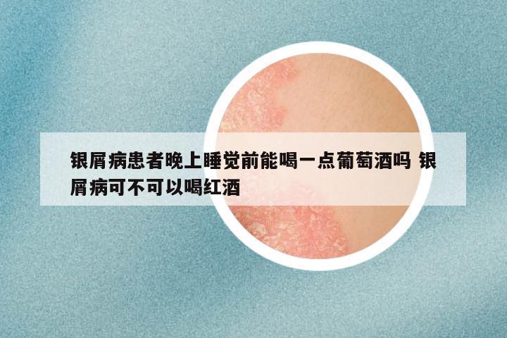 银屑病患者晚上睡觉前能喝一点葡萄酒吗 银屑病可不可以喝红酒