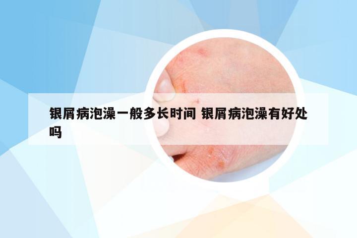 银屑病泡澡一般多长时间 银屑病泡澡有好处吗