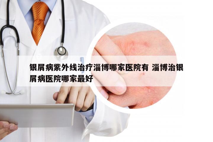 银屑病紫外线治疗淄博哪家医院有 淄博治银屑病医院哪家最好