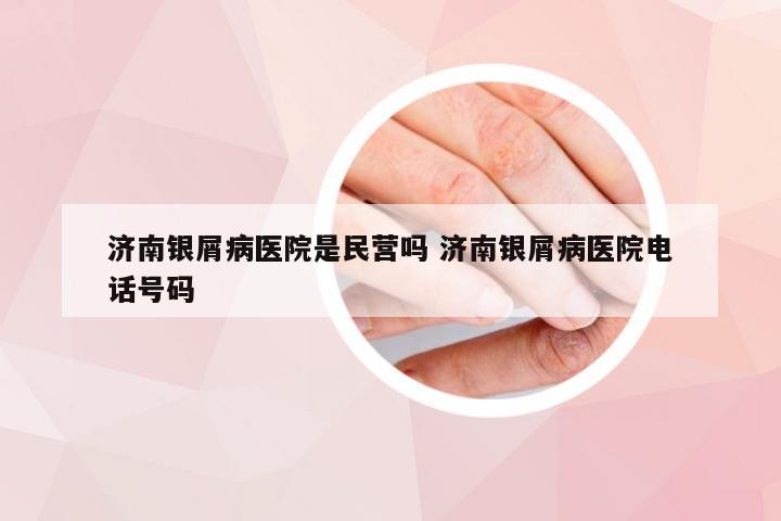 济南银屑病医院是民营吗 济南银屑病医院电话号码