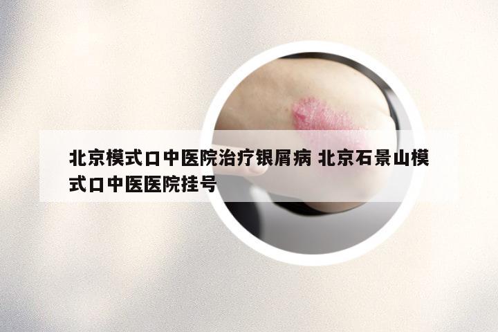 北京模式口中医院治疗银屑病 北京石景山模式口中医医院挂号