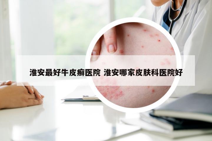 淮安最好牛皮癣医院 淮安哪家皮肤科医院好