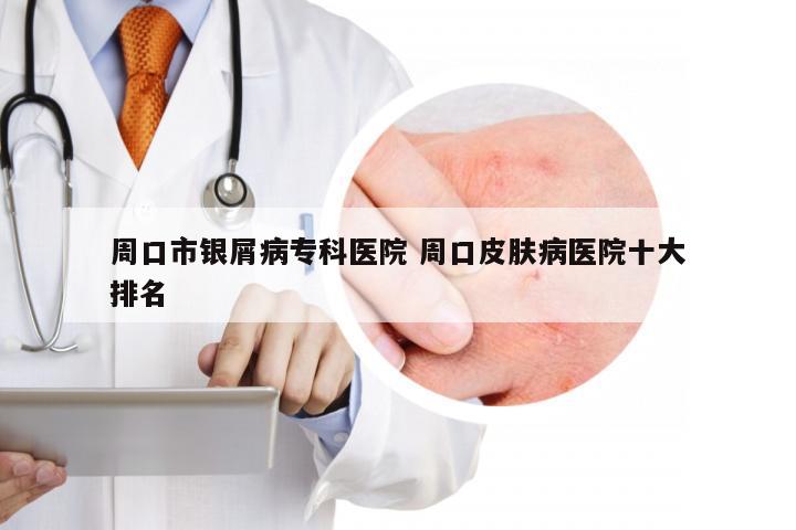 周口市银屑病专科医院 周口皮肤病医院十大排名